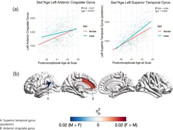 Половые различия в структуре мозга присутствуют при рождении