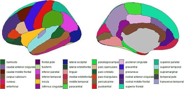 Парцелляция мозга Desikan–Killiany